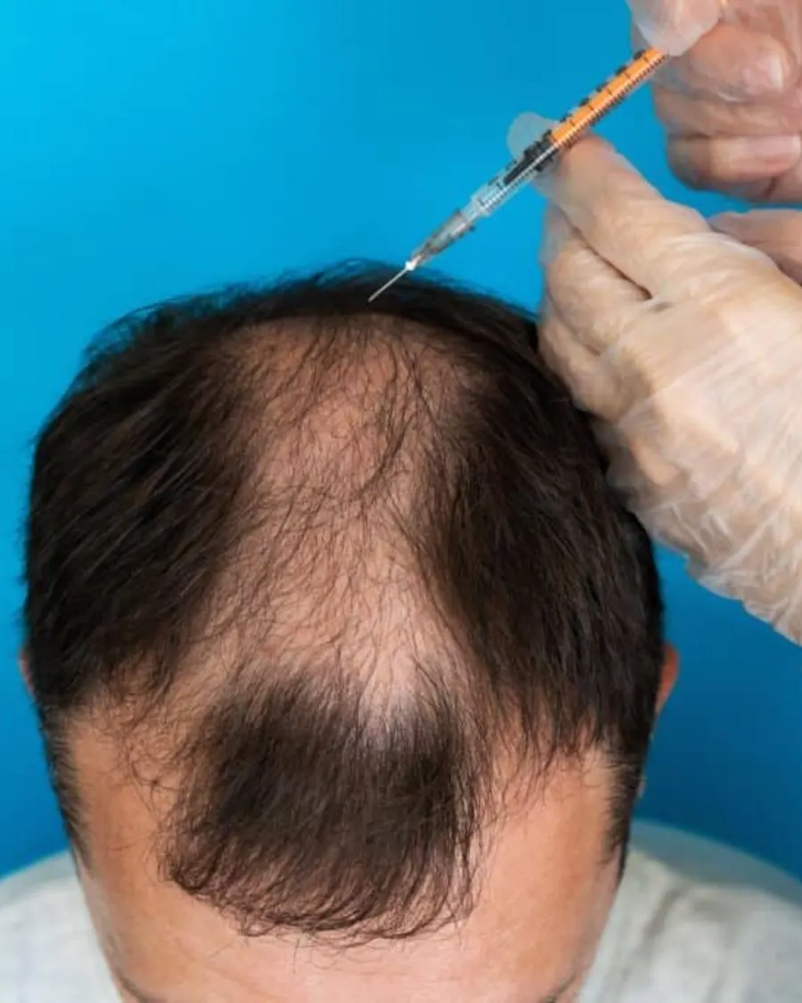 Advanced Mesotherapy Care at Cinch Clinics
