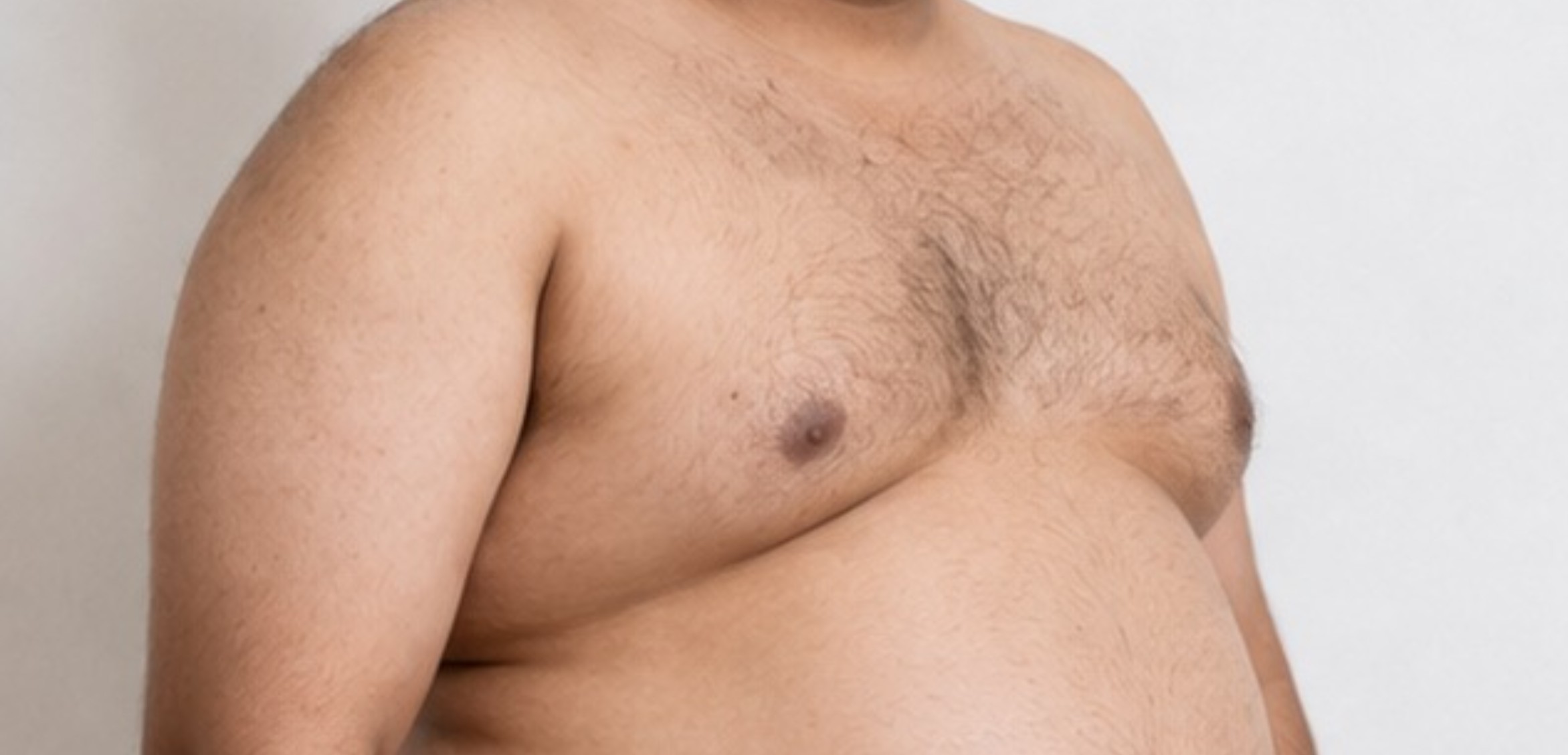 Before treatment - CINCH CLINICS