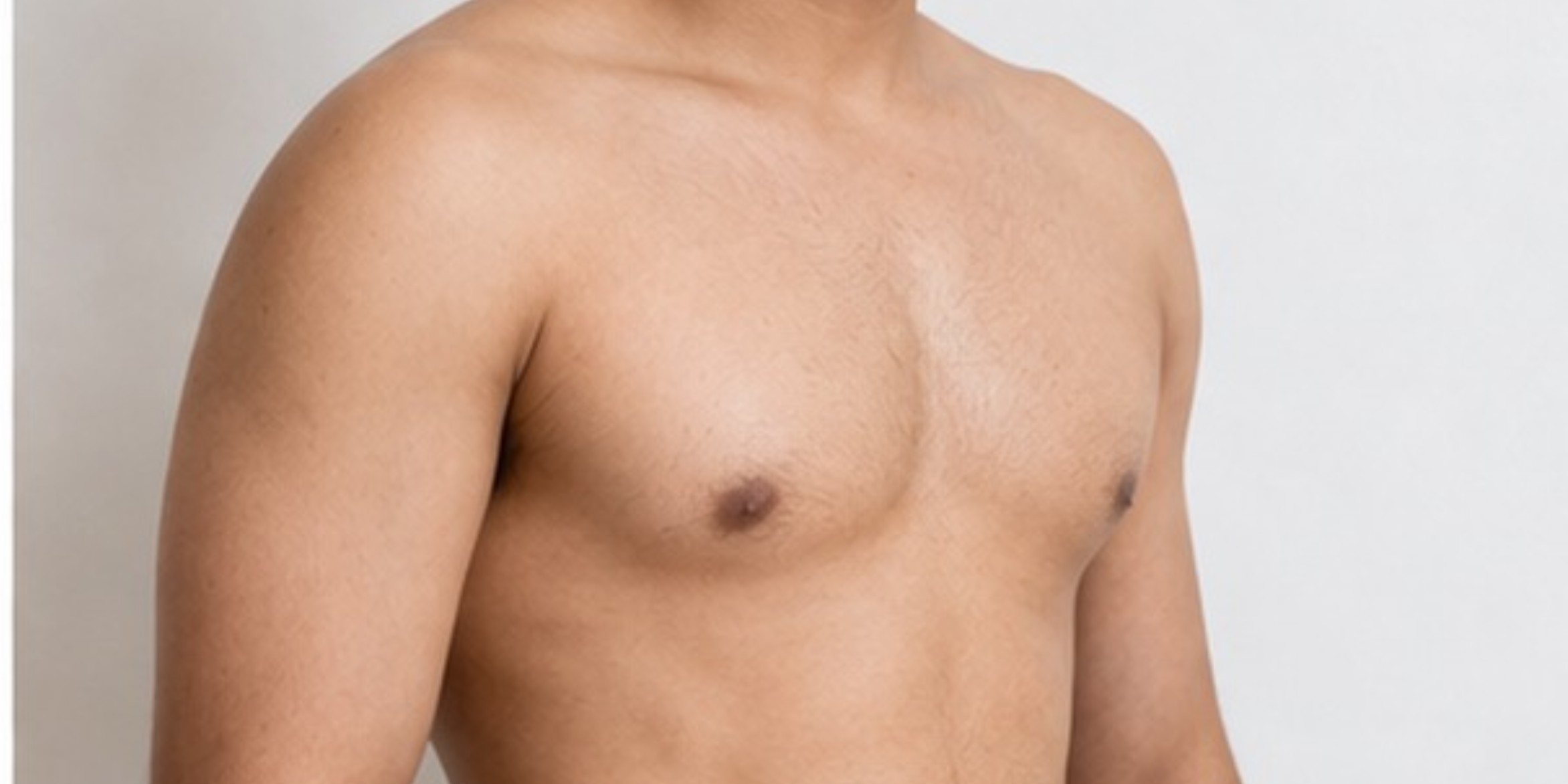 After treatment - CINCH CLINICS