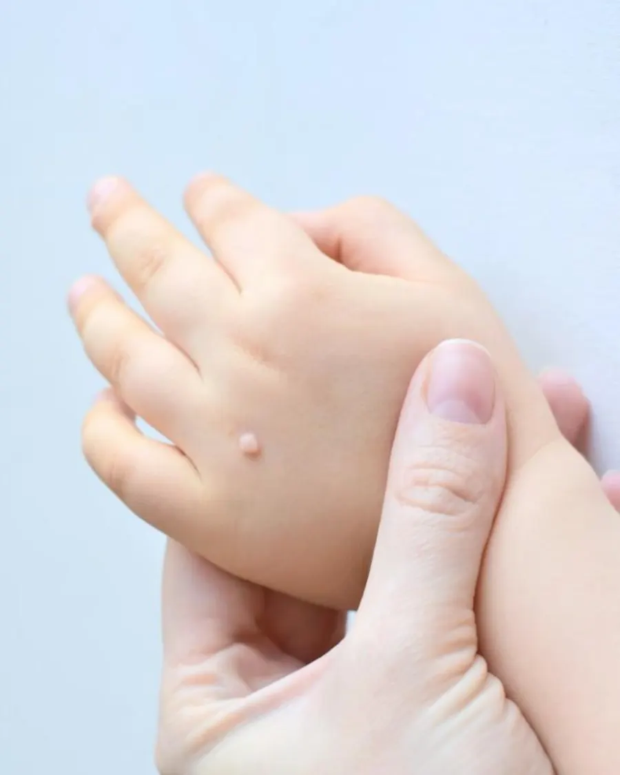 Expert Pediatric Dermatology Care at Cinch Clinics